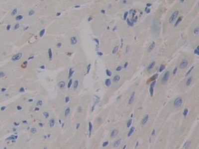 Polyclonal Antibody to Pentraxin 3, Long (PTX3)