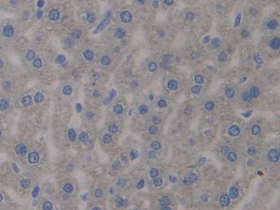 Polyclonal Antibody to Pentraxin 3, Long (PTX3)