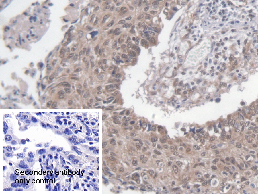 Polyclonal Antibody to Dicer 1, Ribonuclease Type III (DICER1)