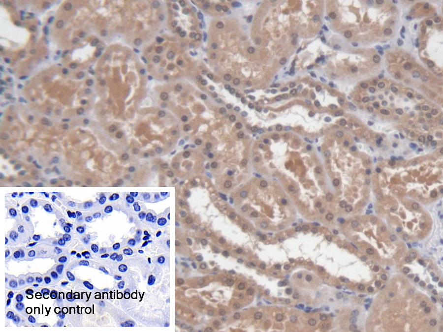 Polyclonal Antibody to Dicer 1, Ribonuclease Type III (DICER1)