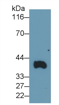 Polyclonal Antibody to Transmembrane Protein 27 (TMEM27)