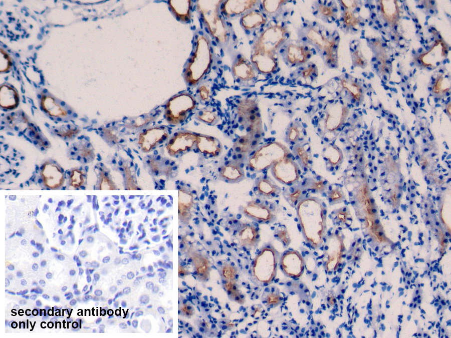 Polyclonal Antibody to Transmembrane Protein 27 (TMEM27)