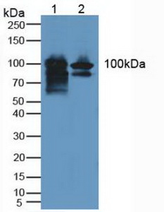 Polyclonal Antibody to GRB2 Associated Binding Protein 1 (GAB1)