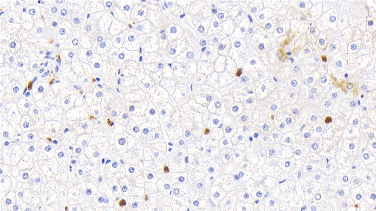 Polyclonal Antibody to Calprotectin (CALPRO)