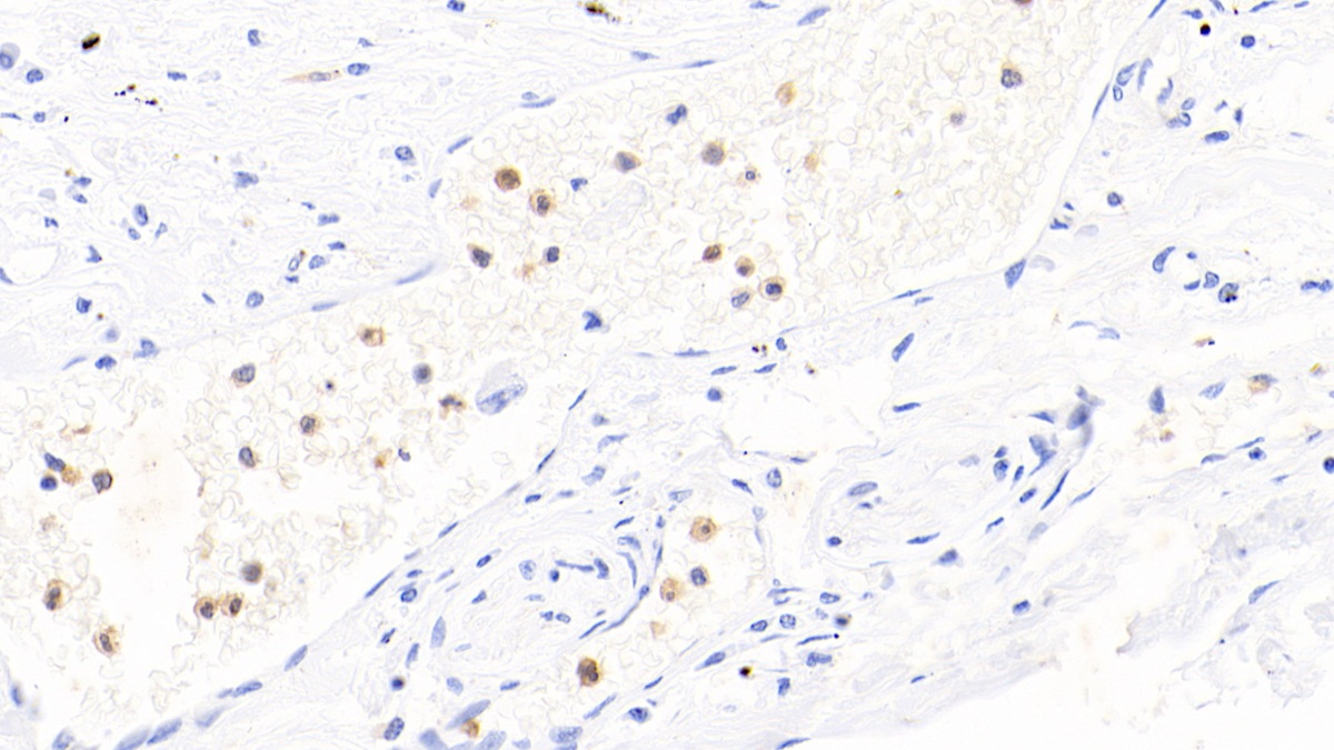 Polyclonal Antibody to Calprotectin (CALPRO)