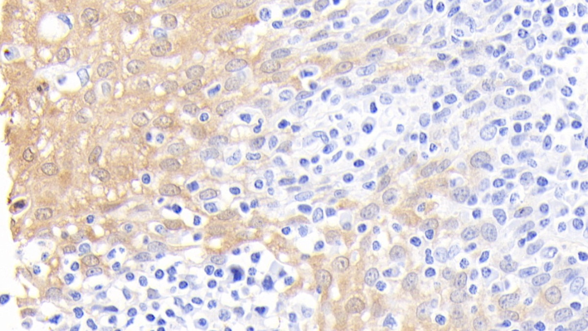 Polyclonal Antibody to Calprotectin (CALPRO)