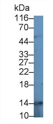 Polyclonal Antibody to Calprotectin (CALPRO)