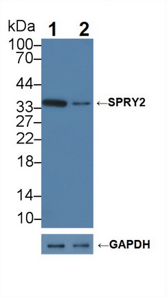 Polyclonal Antibody to Sprouty Homolog 2 (SPRY2)