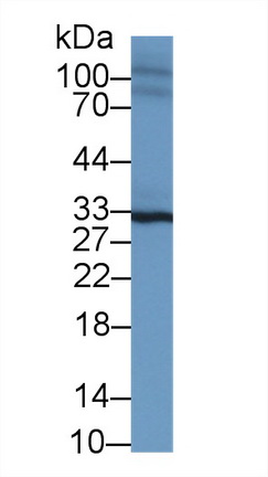 Polyclonal Antibody to Sprouty Homolog 2 (SPRY2)