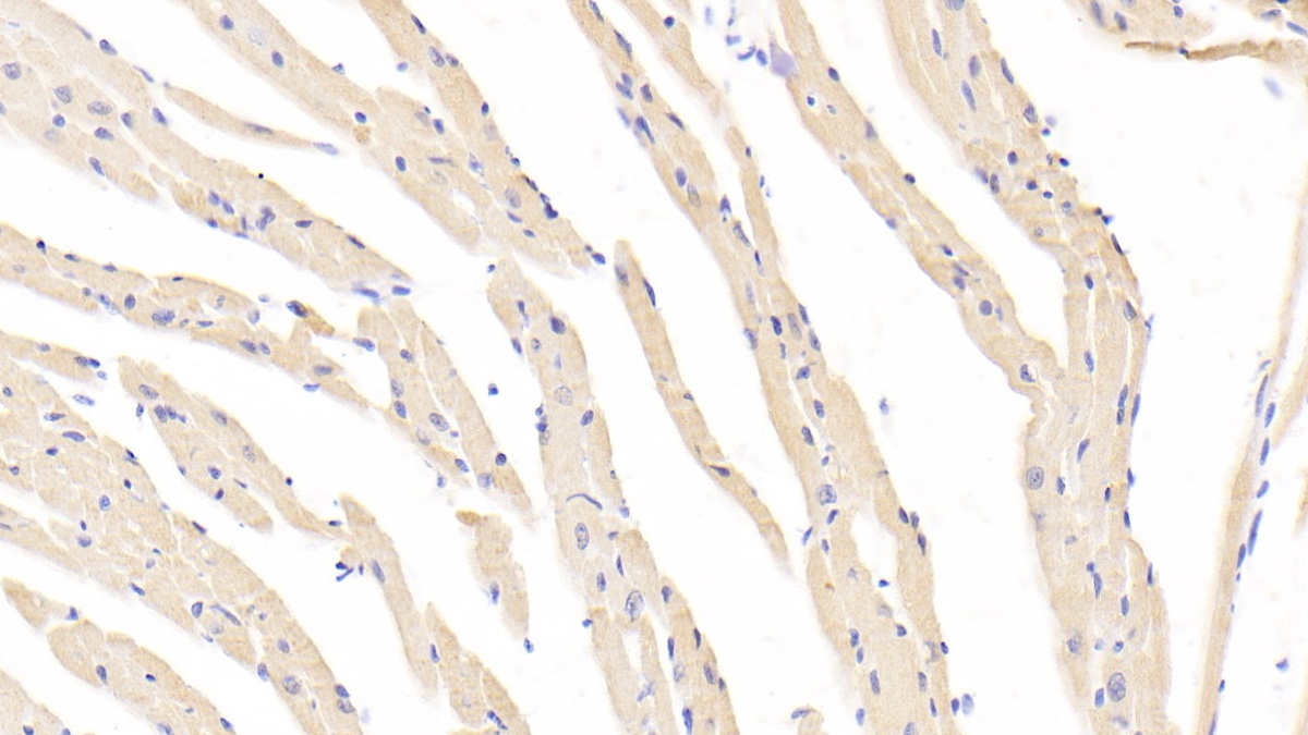 Polyclonal Antibody to Sprouty Homolog 2 (SPRY2)