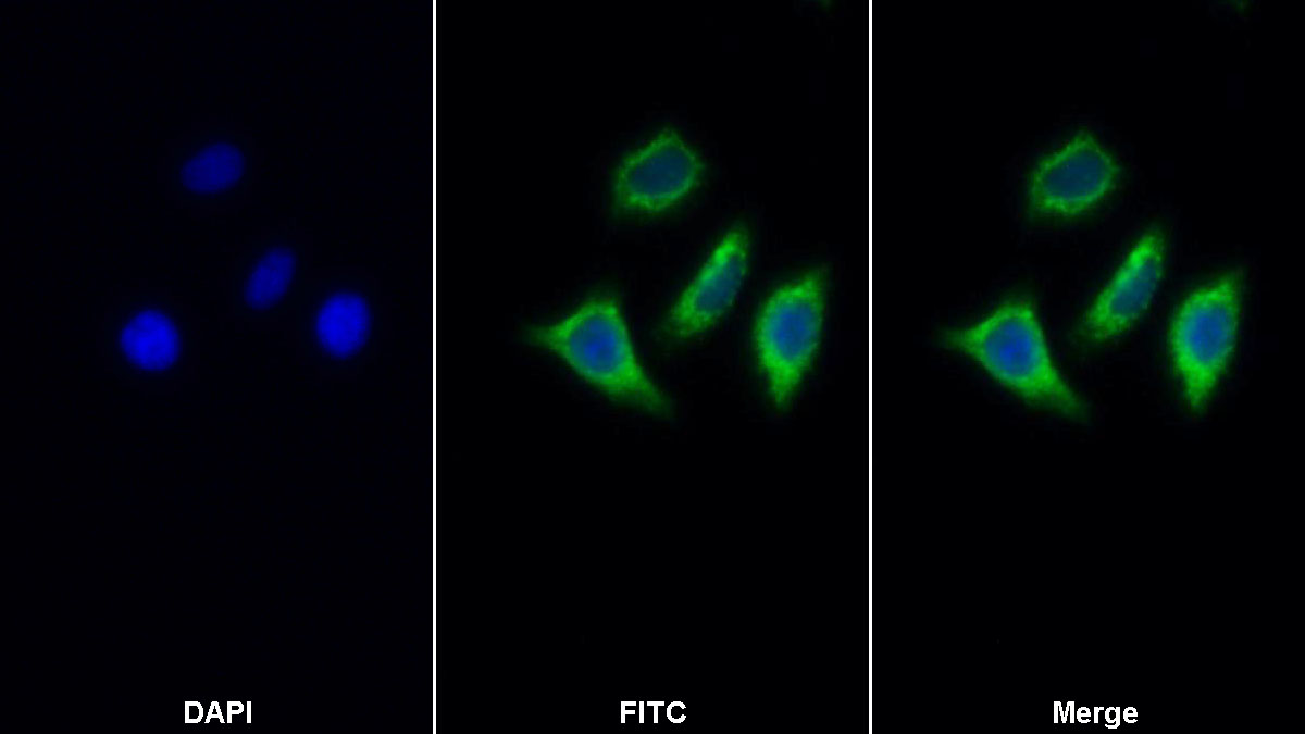 Polyclonal Antibody to PTEN Induced Putative Kinase 1 (PINK1)