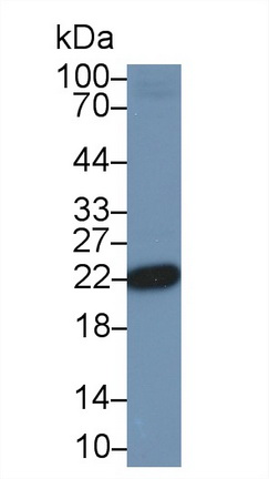 Polyclonal Antibody to Parkinson Disease Protein 7 (PARK7)