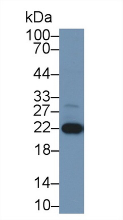 Polyclonal Antibody to Parkinson Disease Protein 7 (PARK7)