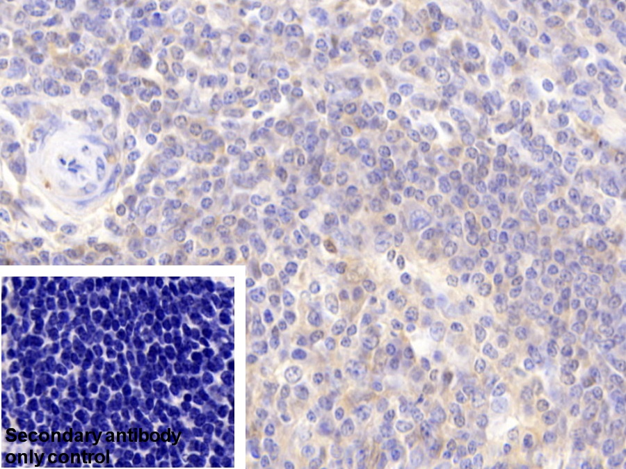 Polyclonal Antibody to Parkinson Disease Protein 7 (PARK7)