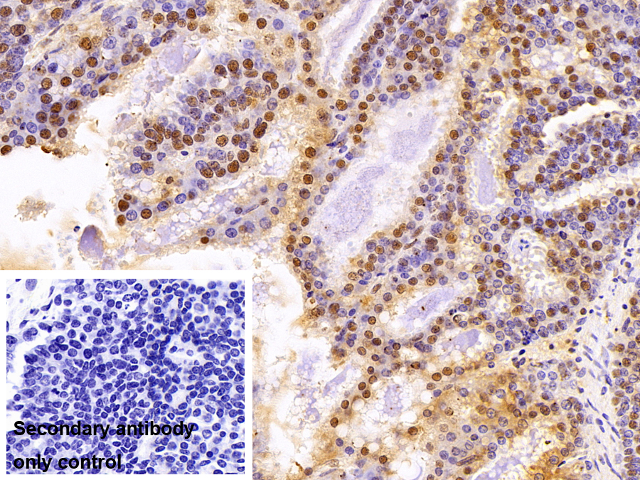 Polyclonal Antibody to Parkinson Disease Protein 7 (PARK7)