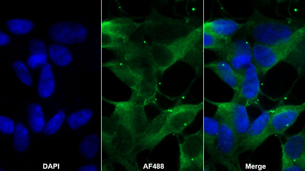 Polyclonal Antibody to Parkinson Disease Protein 7 (PARK7)