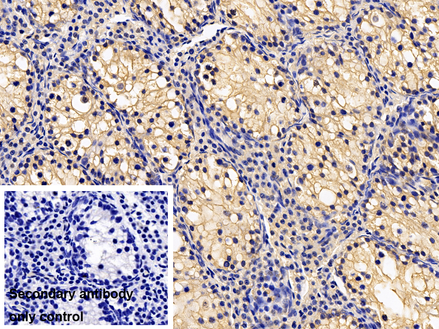 Polyclonal Antibody to Parkinson Disease Protein 7 (PARK7)