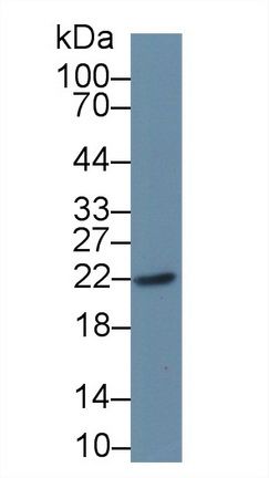 Polyclonal Antibody to Parkinson Disease Protein 7 (PARK7)