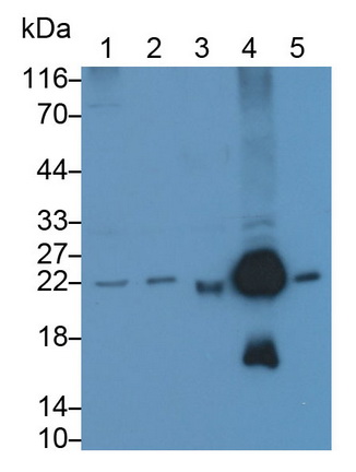 Polyclonal Antibody to Parkinson Disease Protein 7 (PARK7)