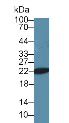 Polyclonal Antibody to Parkinson Disease Protein 7 (PARK7)