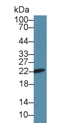 Polyclonal Antibody to Parkinson Disease Protein 7 (PARK7)