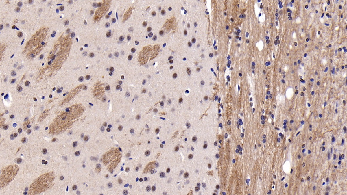 Polyclonal Antibody to Parkinson Disease Protein 2 (PARK2)