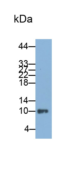 Polyclonal Antibody to Niemann Pick Disease Type C2 (NPC2)