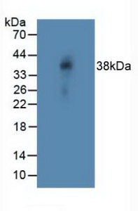 Polyclonal Antibody to Notch Homolog 4 (NOTCH4)