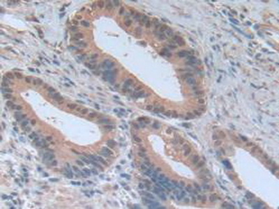 Polyclonal Antibody to Notch Homolog 4 (NOTCH4)