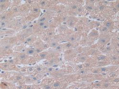 Polyclonal Antibody to Notch Homolog 4 (NOTCH4)