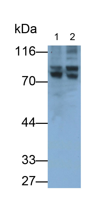 Polyclonal Antibody to Angiogenic Factor With G Patch And FHA Domains 1 (AGGF1)