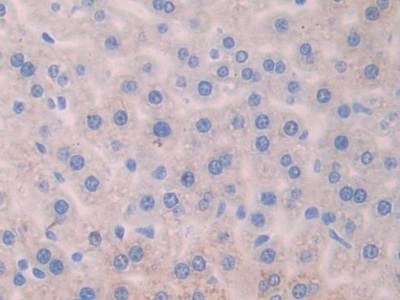 Polyclonal Antibody to Angiogenic Factor With G Patch And FHA Domains 1 (AGGF1)