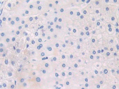 Polyclonal Antibody to Adaptor Protein Phosphotyrosine Interaction PH Domain And leucine Zipper Containing Protein 1 (APPL1)