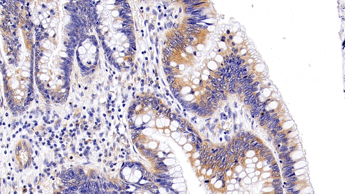 Polyclonal Antibody to Autophagy Related Protein 5 (ATG5)