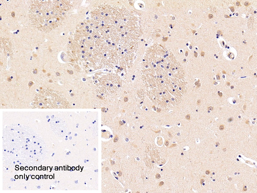 Polyclonal Antibody to Autophagy Related Protein 5 (ATG5)