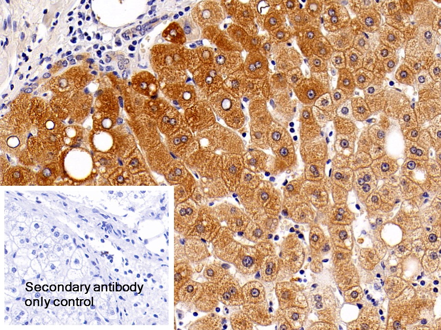 Polyclonal Antibody to Autophagy Related Protein 5 (ATG5)