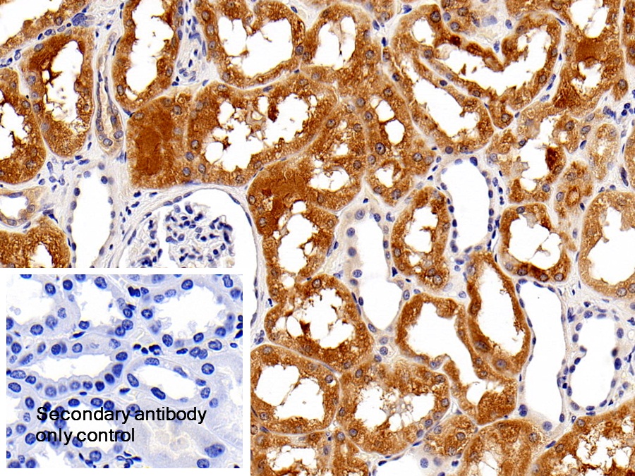 Polyclonal Antibody to Autophagy Related Protein 5 (ATG5)