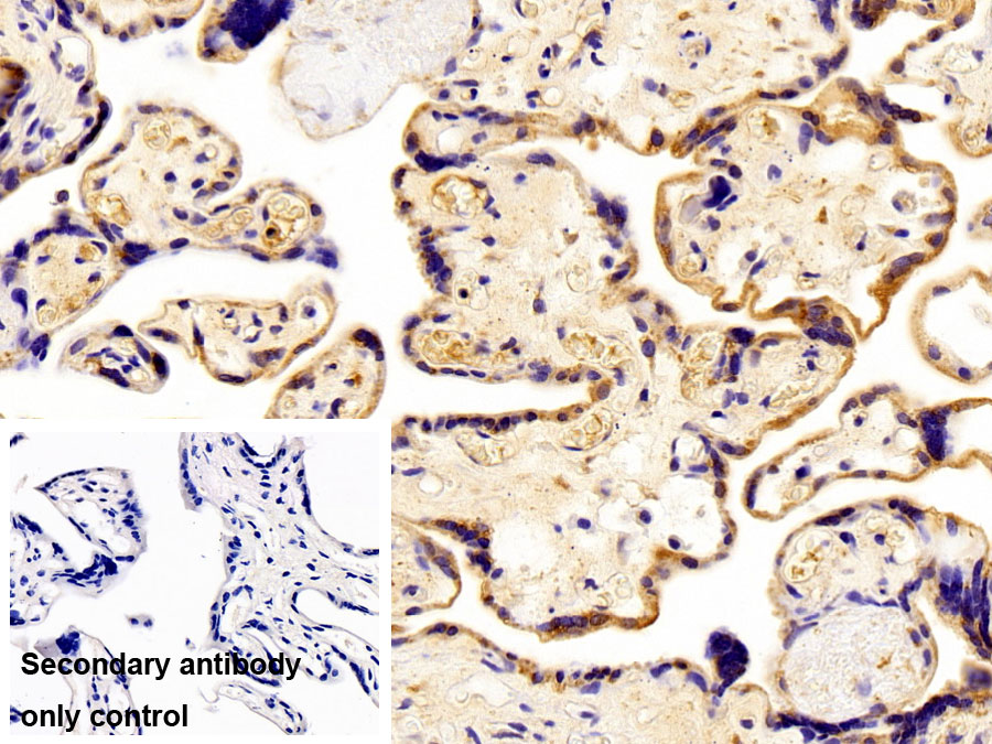 Polyclonal Antibody to Autophagy Related Protein 7 (ATG7)