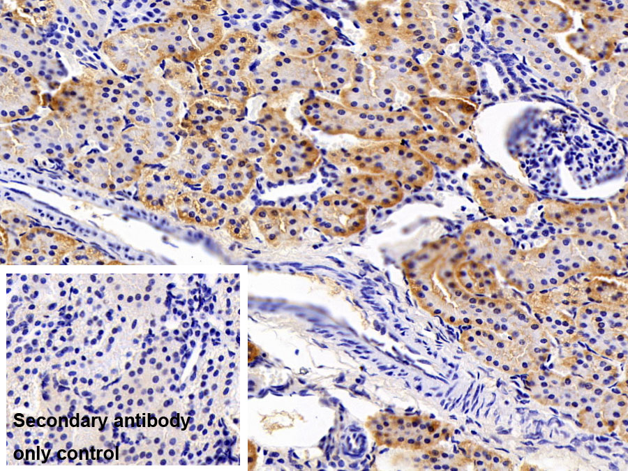 Polyclonal Antibody to Autophagy Related Protein 7 (ATG7)