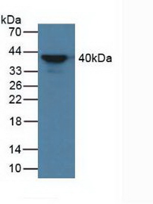 Polyclonal Antibody to Alpha-2-Glycoprotein 1, Zinc Binding (aZGP1)