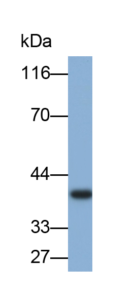 Polyclonal Antibody to Alpha-2-Glycoprotein 1, Zinc Binding (aZGP1)