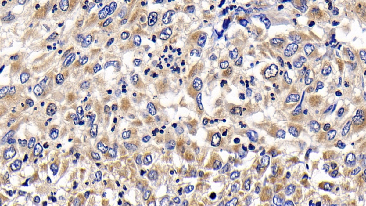 Polyclonal Antibody to B-Cell CLL/Lymphoma 2 Like Protein 2 (Bcl2L2)