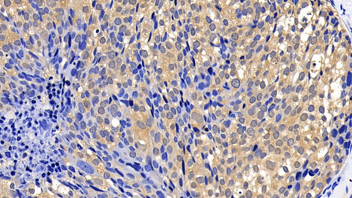 Polyclonal Antibody to B-Cell CLL/Lymphoma 2 Like Protein 2 (Bcl2L2)