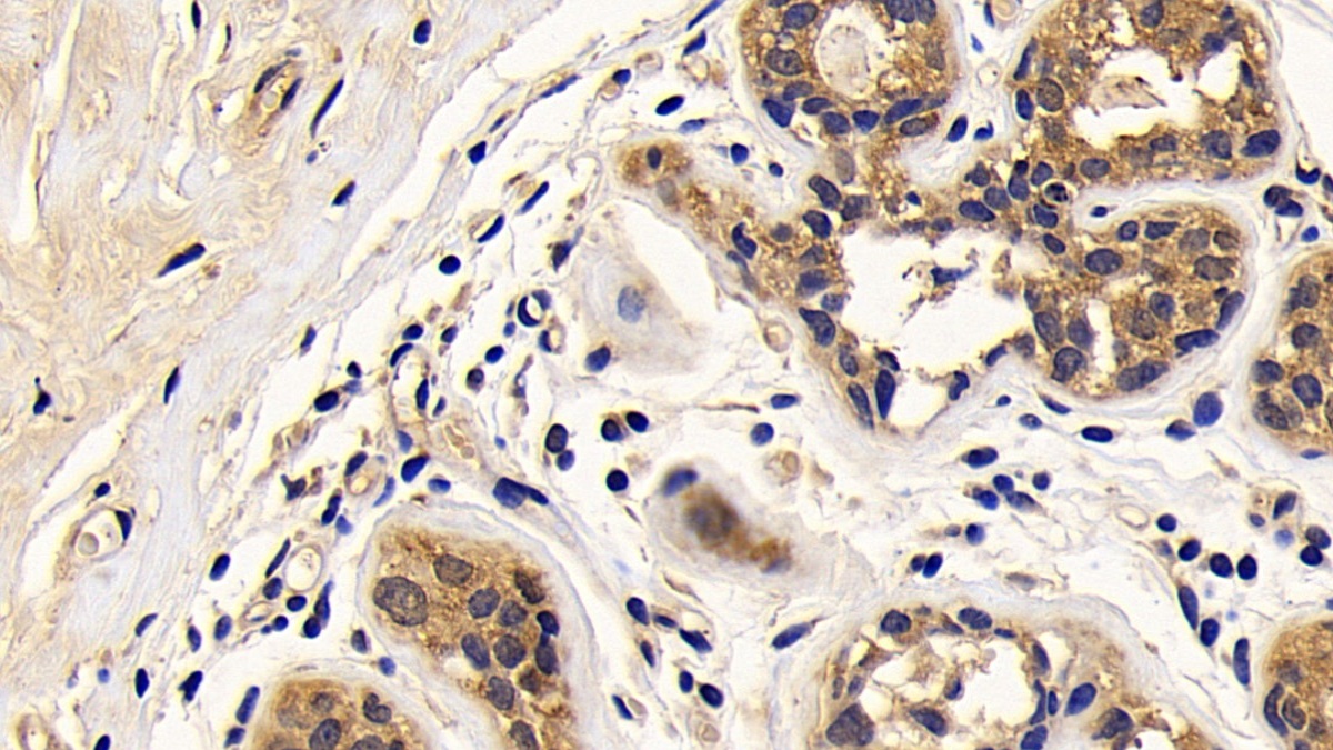 Polyclonal Antibody to B-Cell CLL/Lymphoma 2 Like Protein 2 (Bcl2L2)