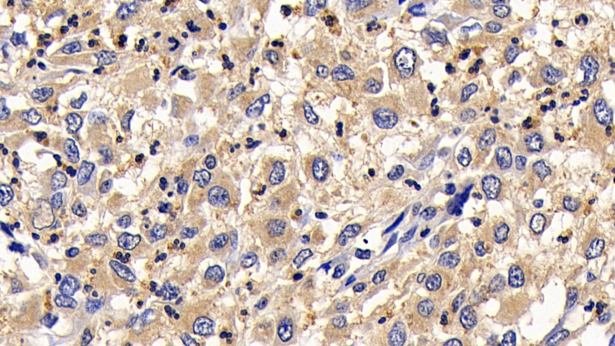 Polyclonal Antibody to B-Cell CLL/Lymphoma 2 Like Protein 2 (Bcl2L2)