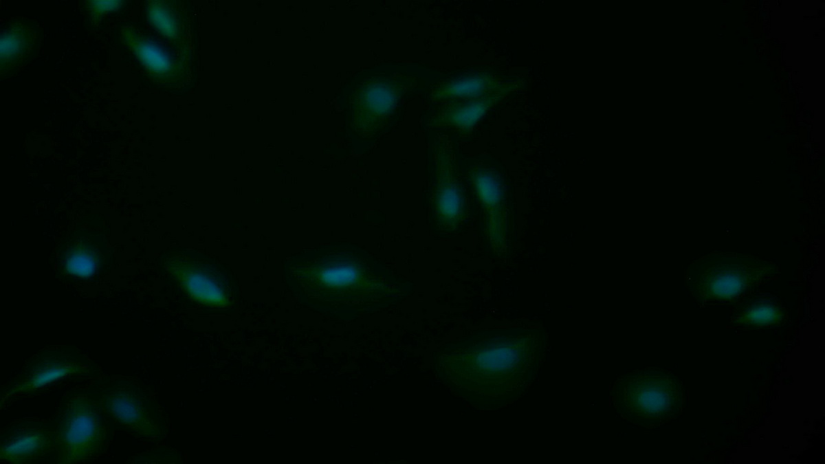 Polyclonal Antibody to B-Cell CLL/Lymphoma 2 Like Protein 2 (Bcl2L2)