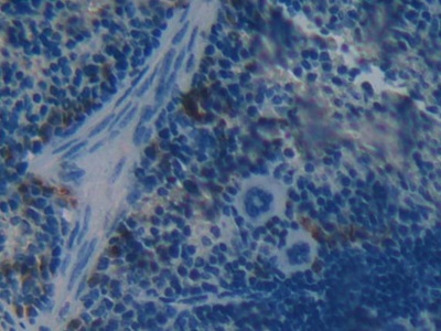 Polyclonal Antibody to Brother Of CDO Homolog (BOC)