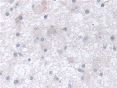 Polyclonal Antibody to Chaperonin Containing TCP1, Subunit 2 (CCT2)