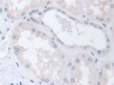 Polyclonal Antibody to Chaperonin Containing TCP1, Subunit 2 (CCT2)