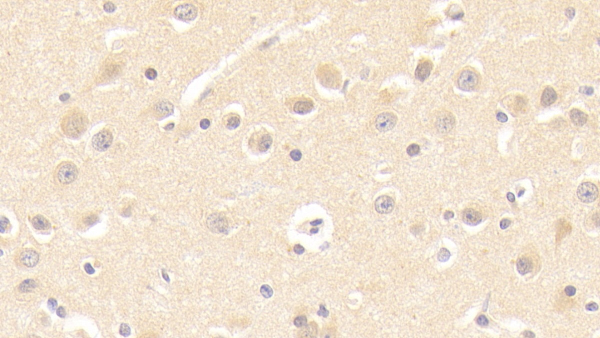 Polyclonal Antibody to Chaperonin Containing TCP1, Subunit 2 (CCT2)